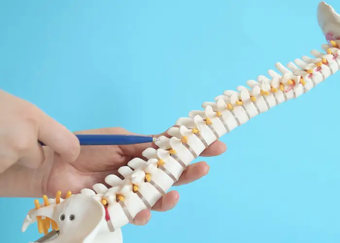 Hand pointing to a vertebra on a spine model to illustrate scoliosis‑related spinal curvature and nerve involvement.
